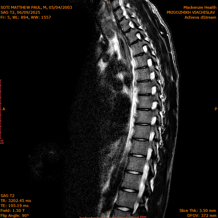 2025-06-09/SAG T2/0006-IM260.png
