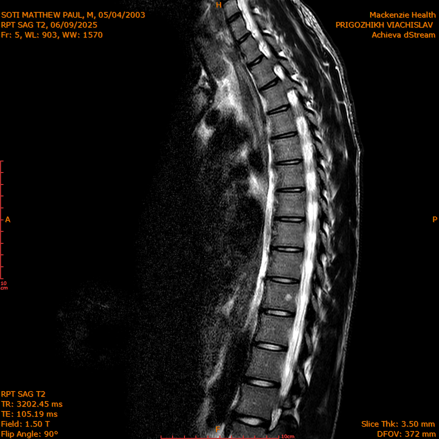 2025-06-09/SAG T2/0006-IM290.png