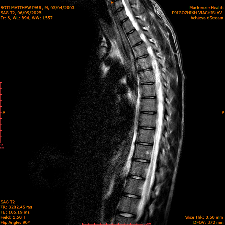 2025-06-09/SAG T2/0007-IM261.png