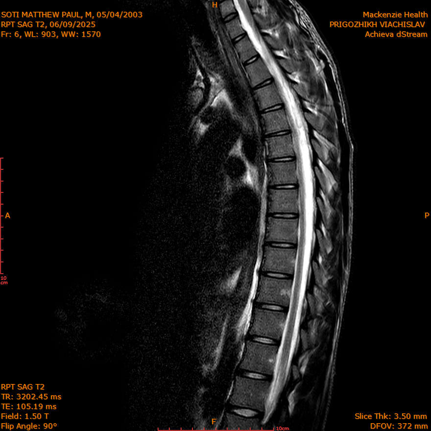 2025-06-09/SAG T2/0007-IM291.png