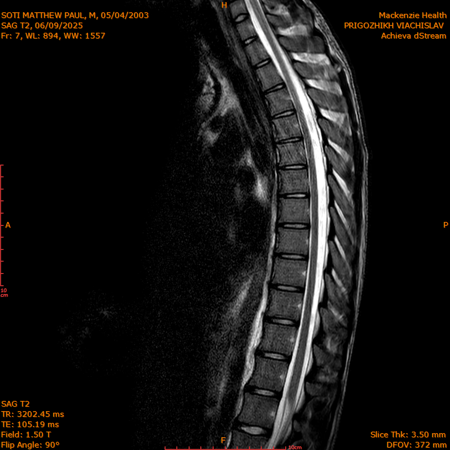 2025-06-09/SAG T2/0008-IM262.png