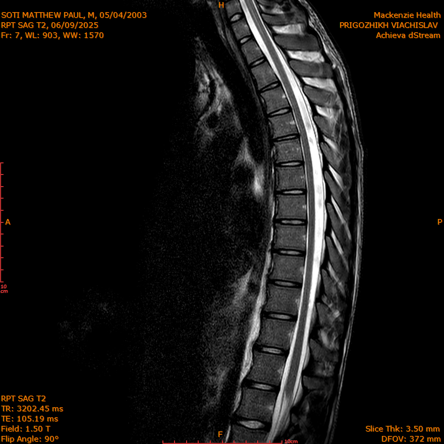 2025-06-09/SAG T2/0008-IM292.png