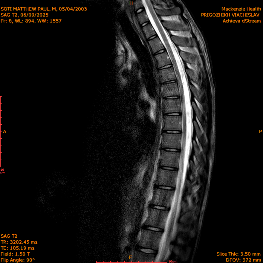 2025-06-09/SAG T2/0009-IM263.png