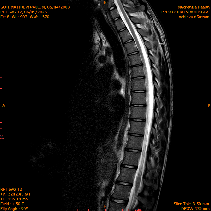2025-06-09/SAG T2/0009-IM293.png