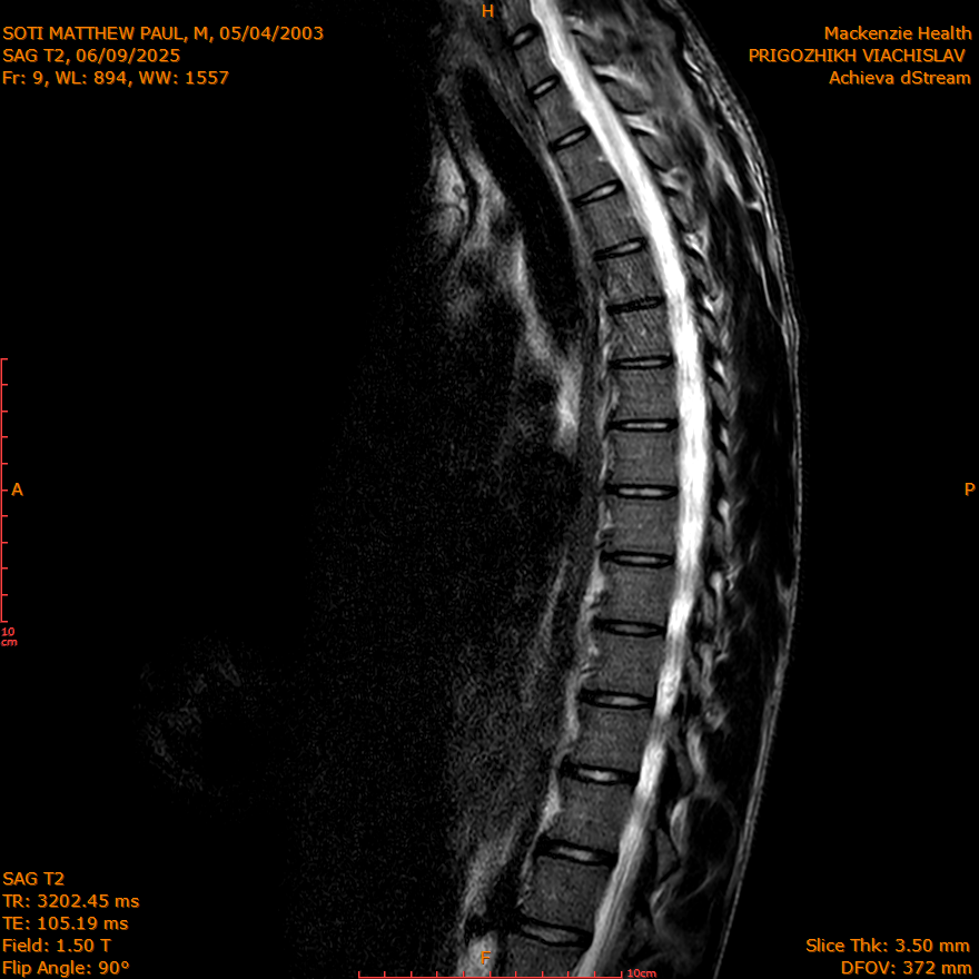 2025-06-09/SAG T2/0010-IM264.png