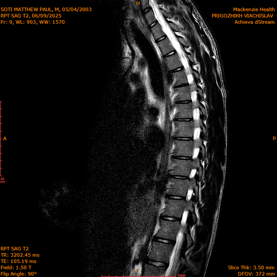 2025-06-09/SAG T2/0010-IM294.png