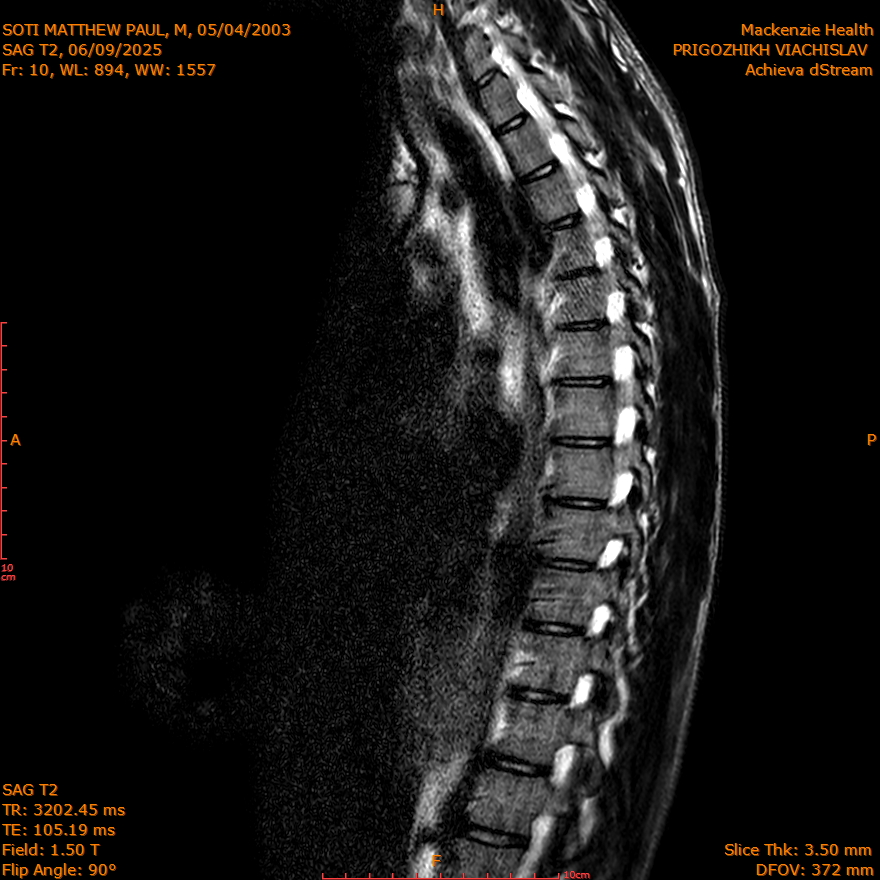 2025-06-09/SAG T2/0011-IM265.png