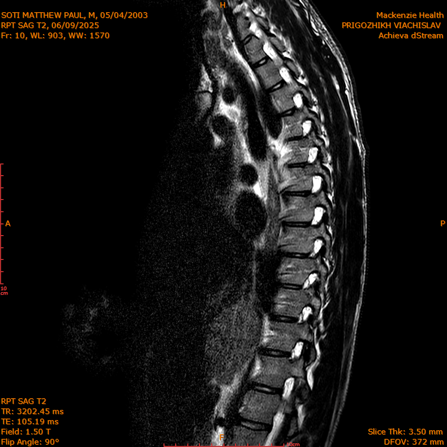 2025-06-09/SAG T2/0011-IM295.png