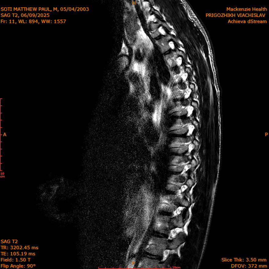 2025-06-09/SAG T2/0012-IM266.png