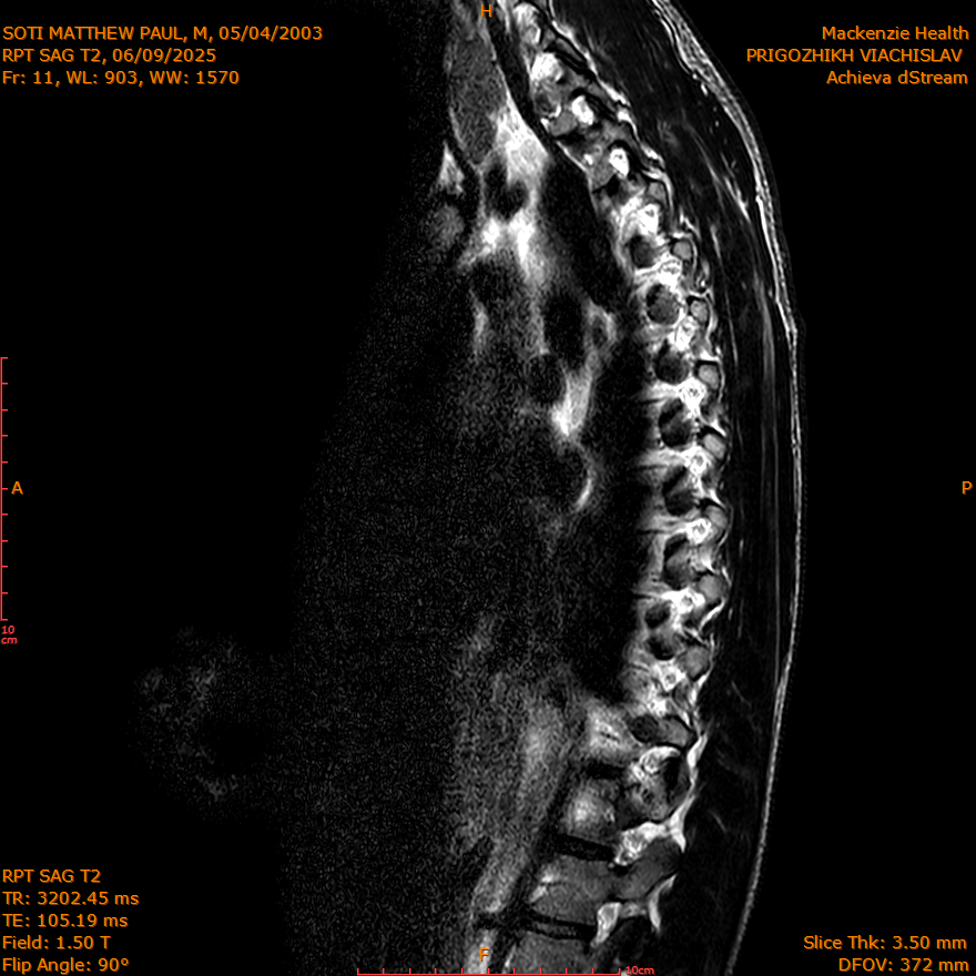 2025-06-09/SAG T2/0012-IM296.png