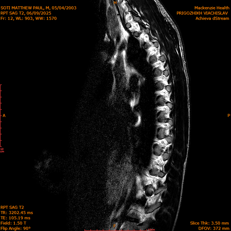 2025-06-09/SAG T2/0013-IM297.png