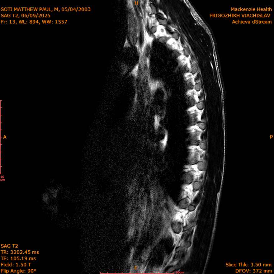 2025-06-09/SAG T2/0014-IM268.png