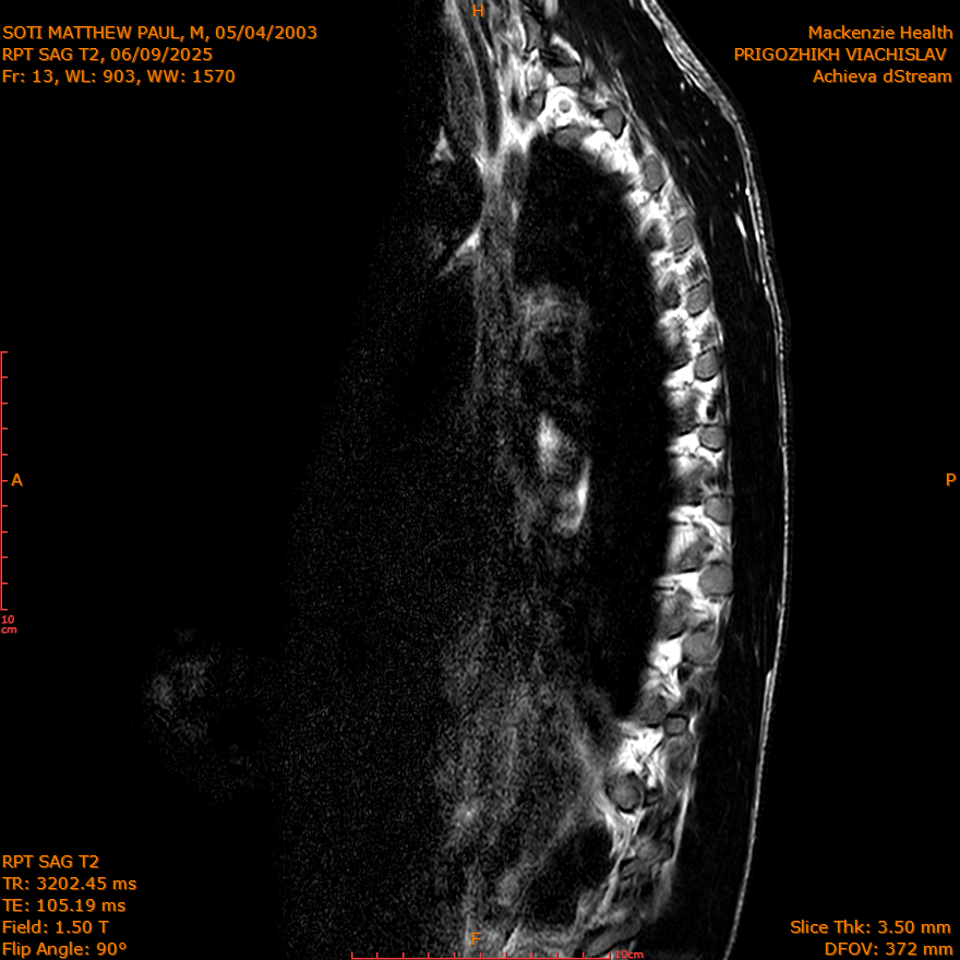 2025-06-09/SAG T2/0014-IM298.png