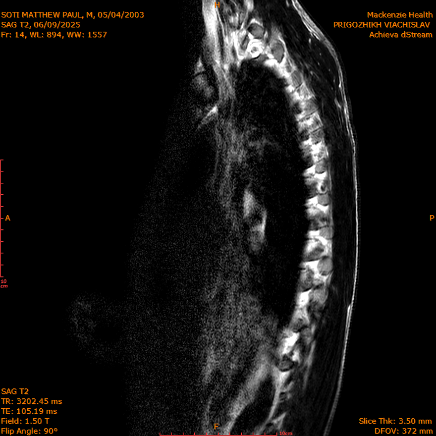 2025-06-09/SAG T2/0015-IM269.png