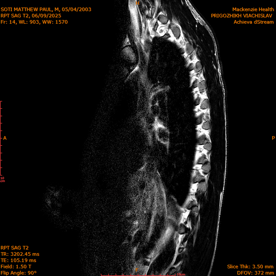 2025-06-09/SAG T2/0015-IM299.png