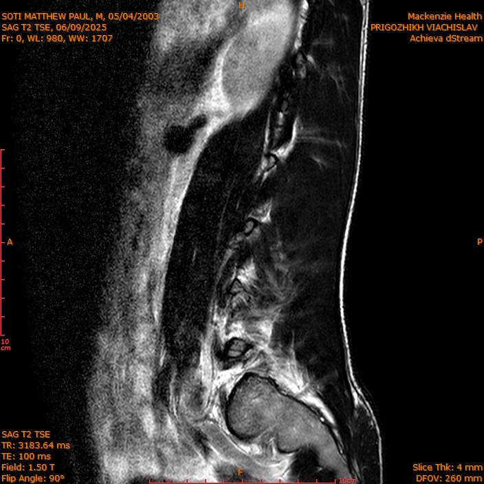 2025-06-09/SAG T2 TSE/0001-IM300.png