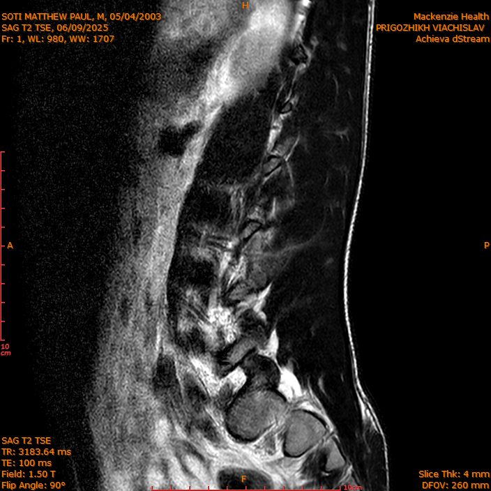 2025-06-09/SAG T2 TSE/0002-IM301.png
