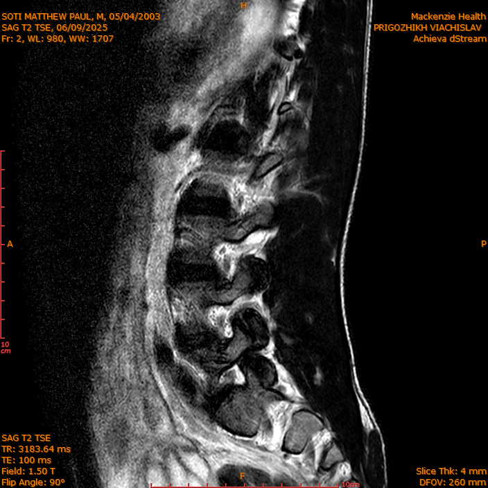 2025-06-09/SAG T2 TSE/0003-IM302.png