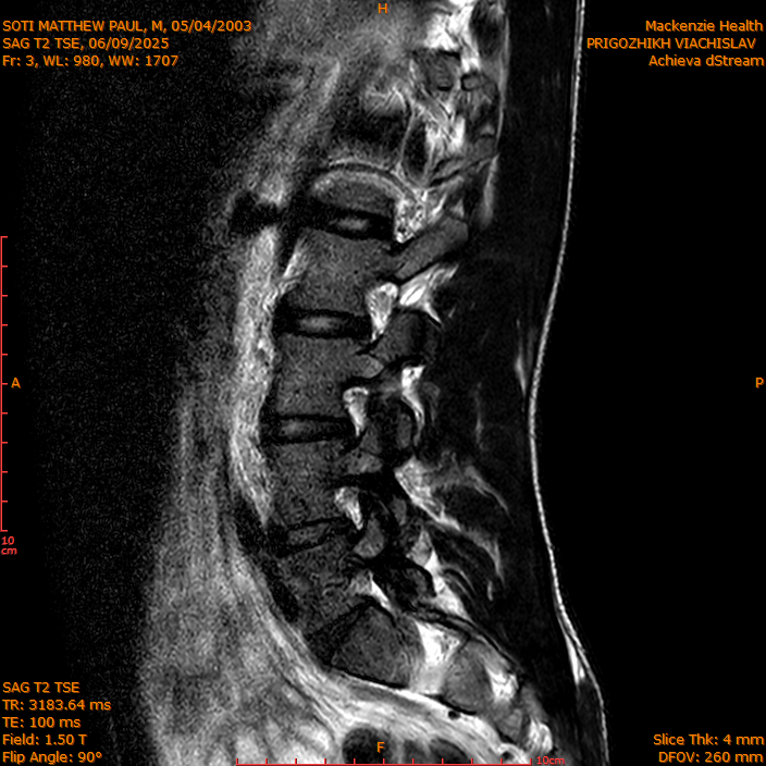 2025-06-09/SAG T2 TSE/0004-IM303.png