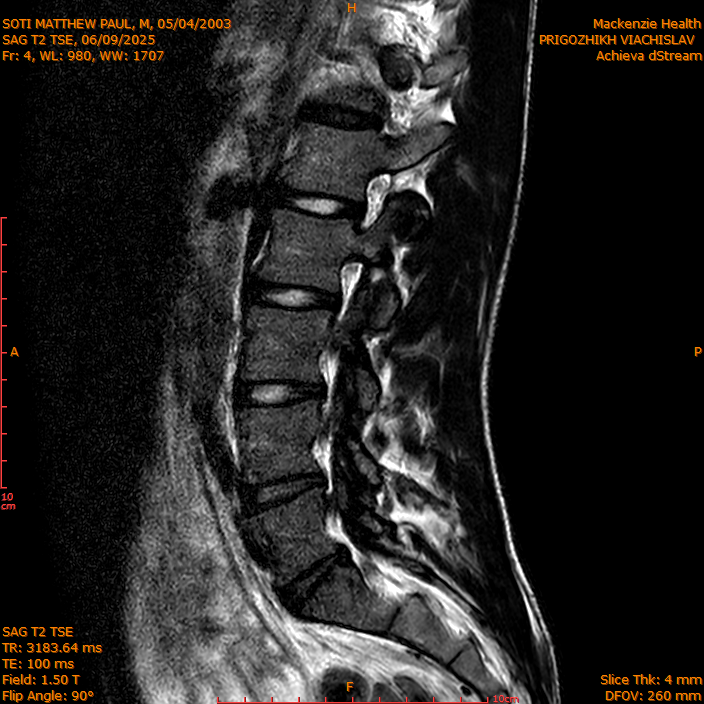 2025-06-09/SAG T2 TSE/0005-IM304.png