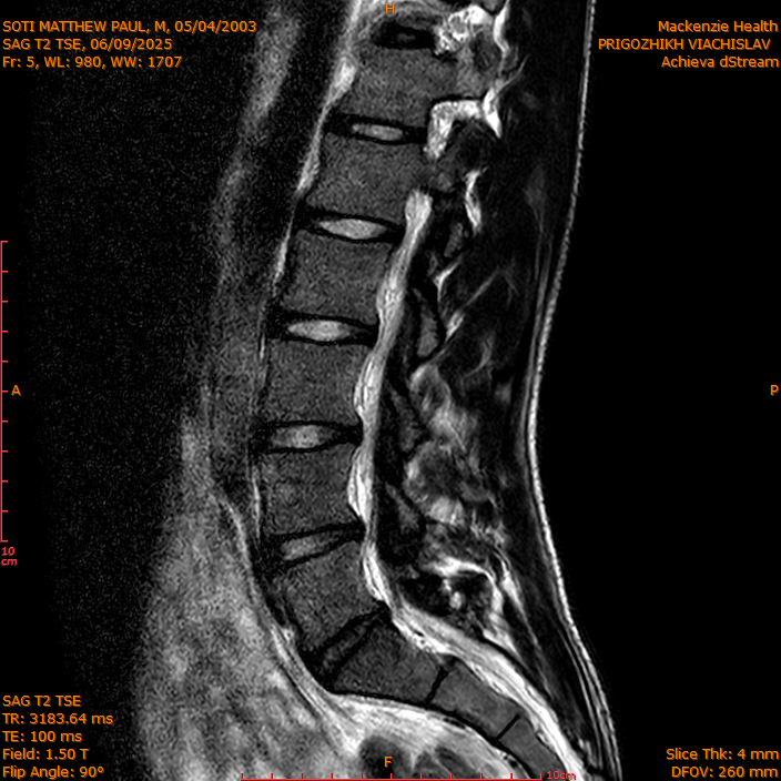 2025-06-09/SAG T2 TSE/0006-IM305.png