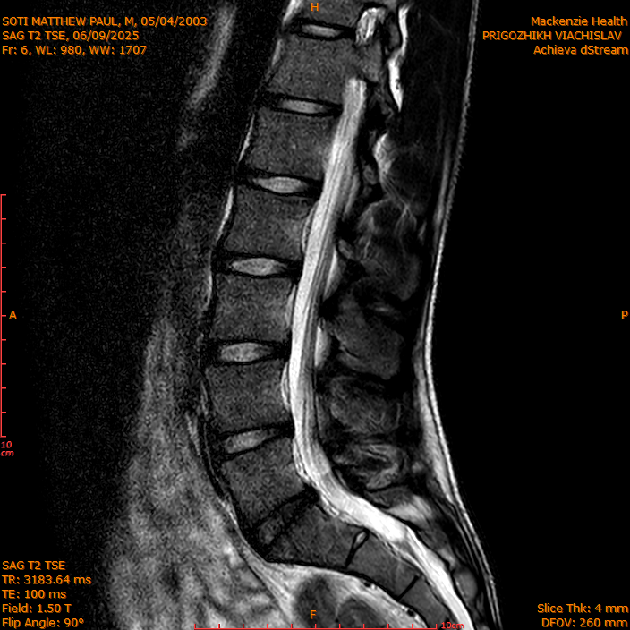 2025-06-09/SAG T2 TSE/0007-IM306.png