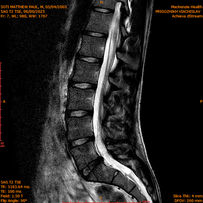 2025-06-09/SAG T2 TSE/0008-IM307.png
