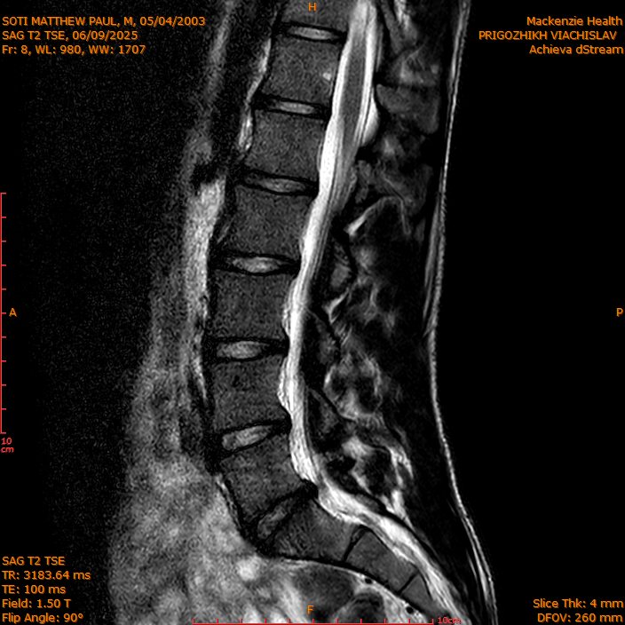 2025-06-09/SAG T2 TSE/0009-IM308.png