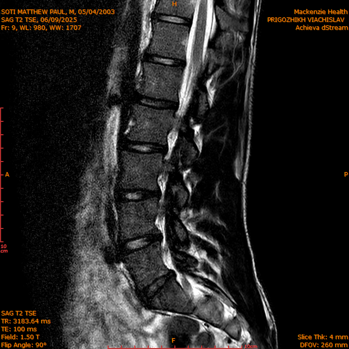 2025-06-09/SAG T2 TSE/0010-IM309.png
