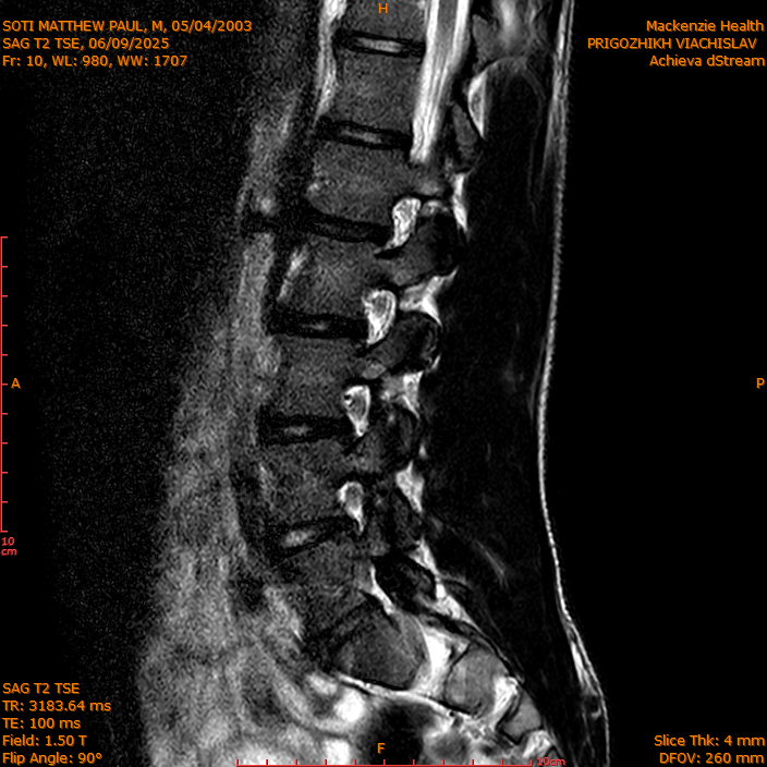 2025-06-09/SAG T2 TSE/0011-IM310.png