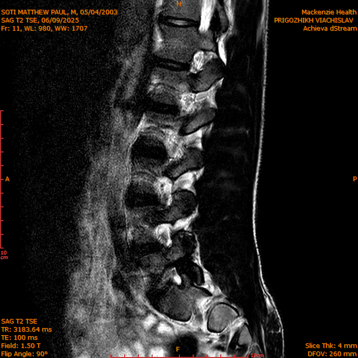 2025-06-09/SAG T2 TSE/0012-IM311.png