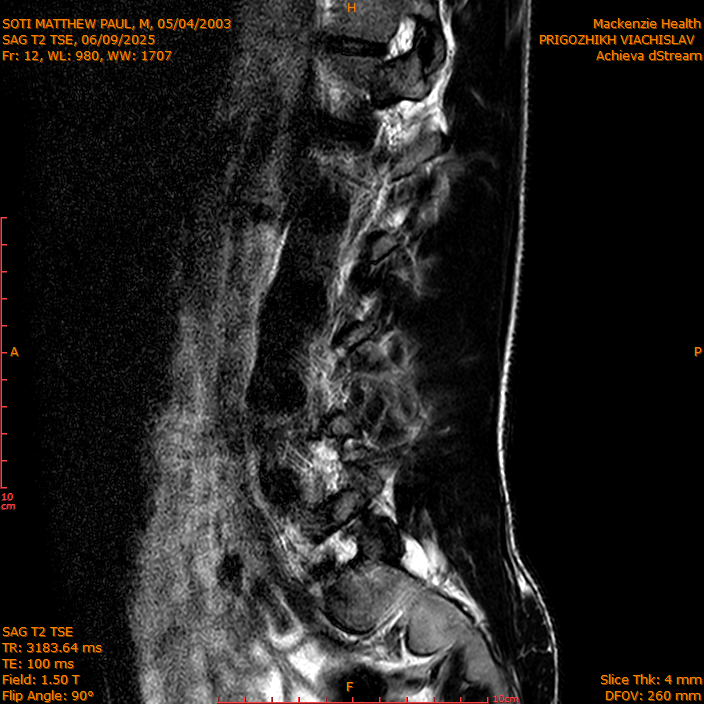 2025-06-09/SAG T2 TSE/0013-IM312.png
