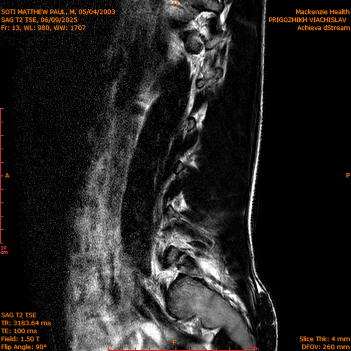 2025-06-09/SAG T2 TSE/0014-IM313.png