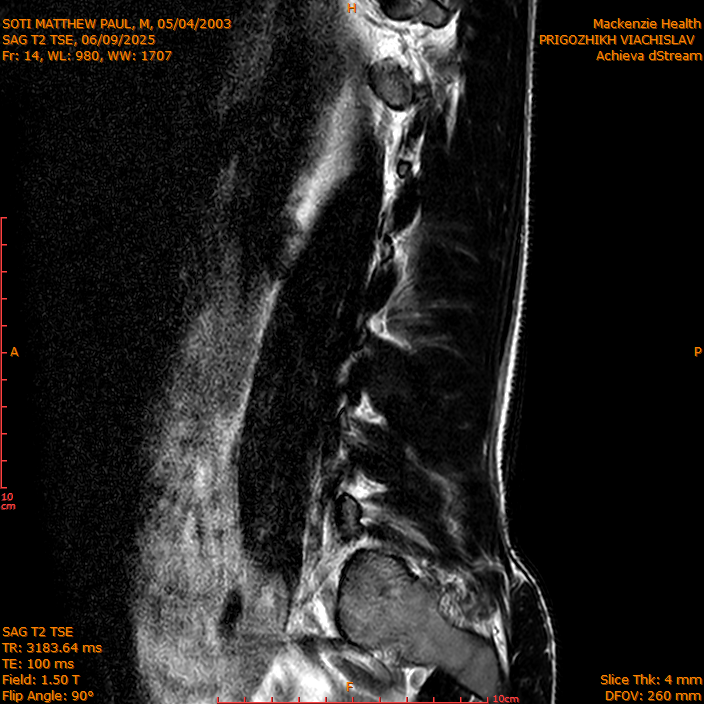 2025-06-09/SAG T2 TSE/0015-IM314.png