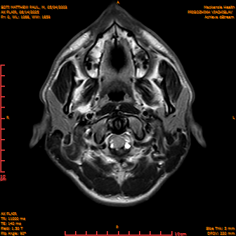 2025-06-14/AX FLAIR/0001-IM862.png