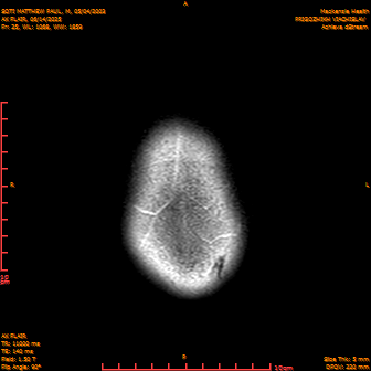 2025-06-14/AX FLAIR/0026-IM887.png