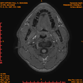 2025-06-14/AX MPR/0006-IM611.png