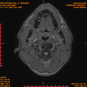 2025-06-14/AX MPR/0008-IM613.png