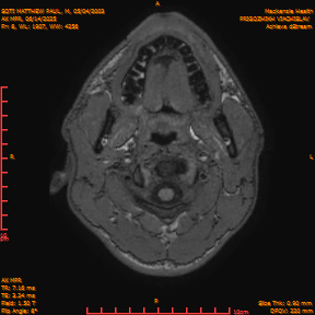 2025-06-14/AX MPR/0009-IM614.png