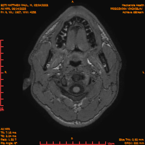 2025-06-14/AX MPR/0010-IM615.png