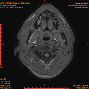2025-06-14/AX MPR/0013-IM618.png