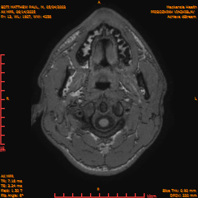 2025-06-14/AX MPR/0014-IM619.png