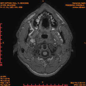 2025-06-14/AX MPR/0018-IM623.png