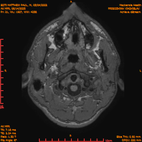 2025-06-14/AX MPR/0022-IM627.png
