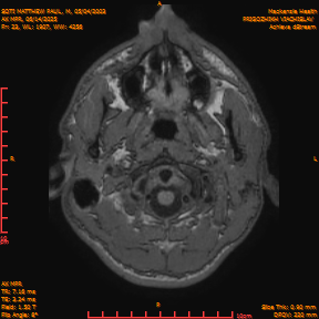2025-06-14/AX MPR/0024-IM629.png