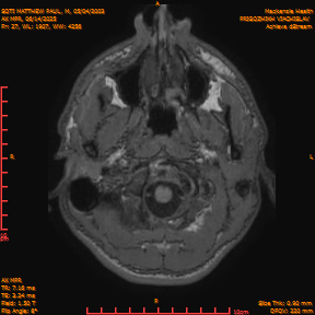 2025-06-14/AX MPR/0028-IM633.png