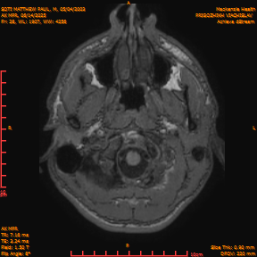 2025-06-14/AX MPR/0029-IM634.png