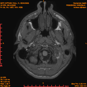 2025-06-14/AX MPR/0031-IM636.png