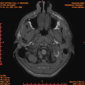2025-06-14/AX MPR/0032-IM637.png