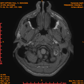 2025-06-14/AX MPR/0033-IM638.png